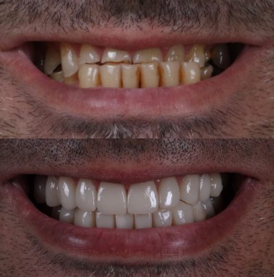 Rehabilitación funcional y estética